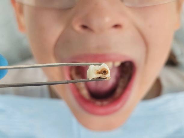 Best Emergency Care for Gum Disease in Leslie, MI